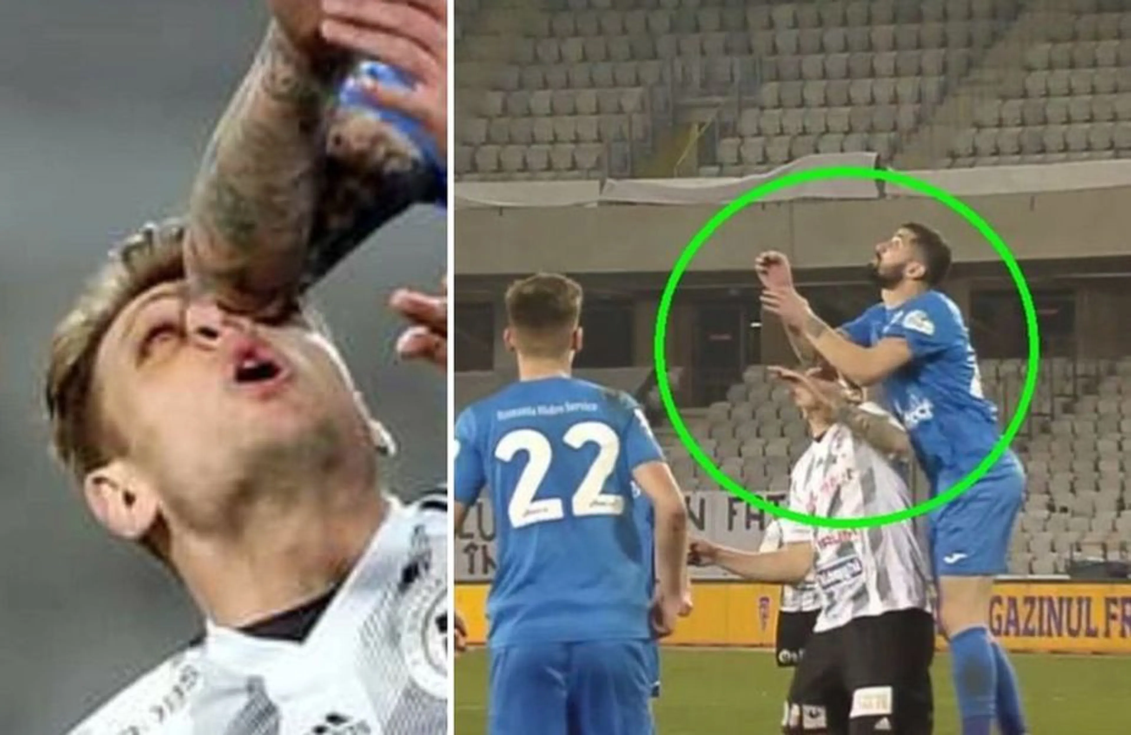 Copertina di Romania, colpisce in pieno occhio l’avversario: niente rigore e rissa in campo