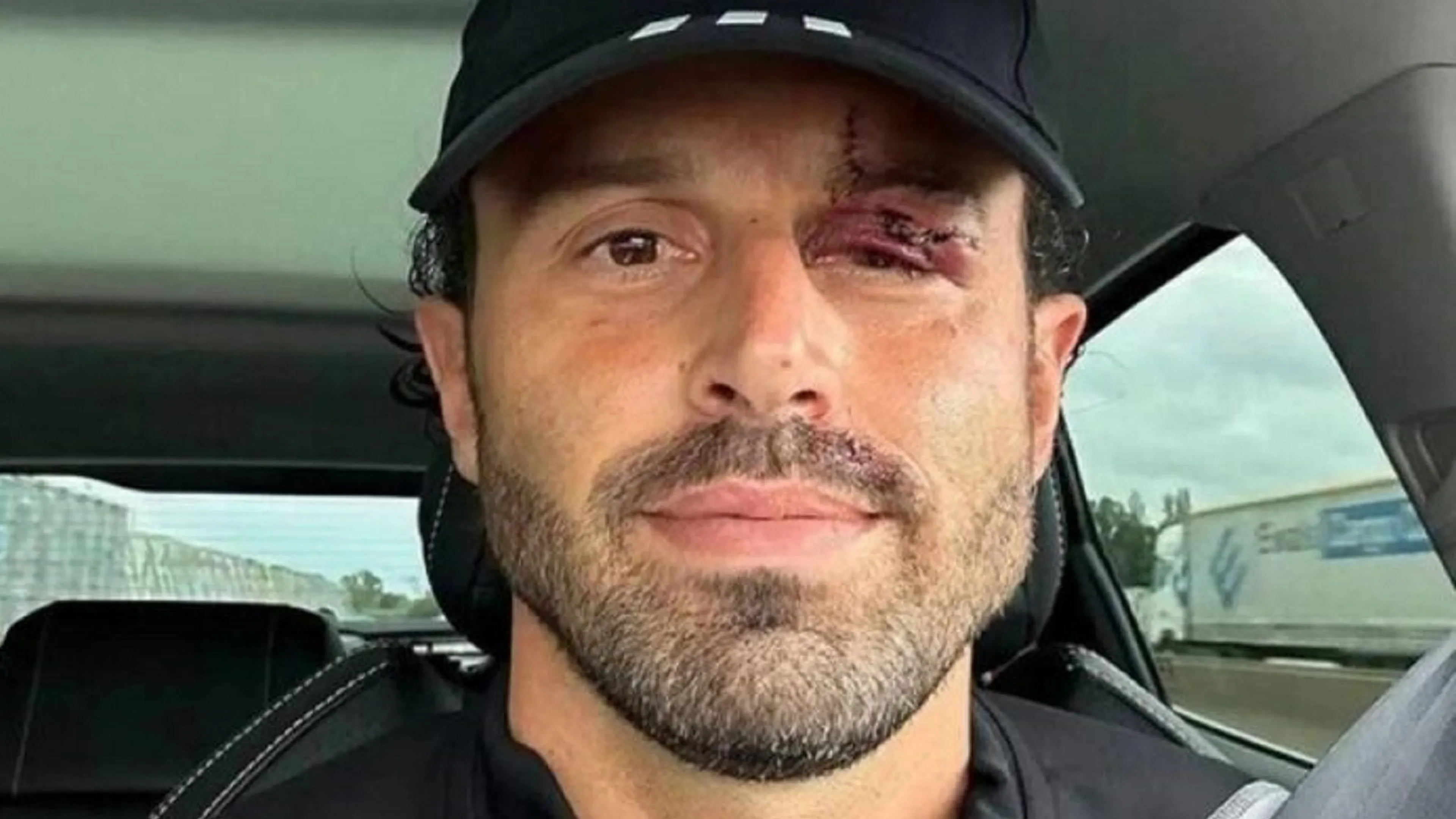 Copertina di "Poteva essere una tragedia", Grosso ancora sotto shock (FOTO)