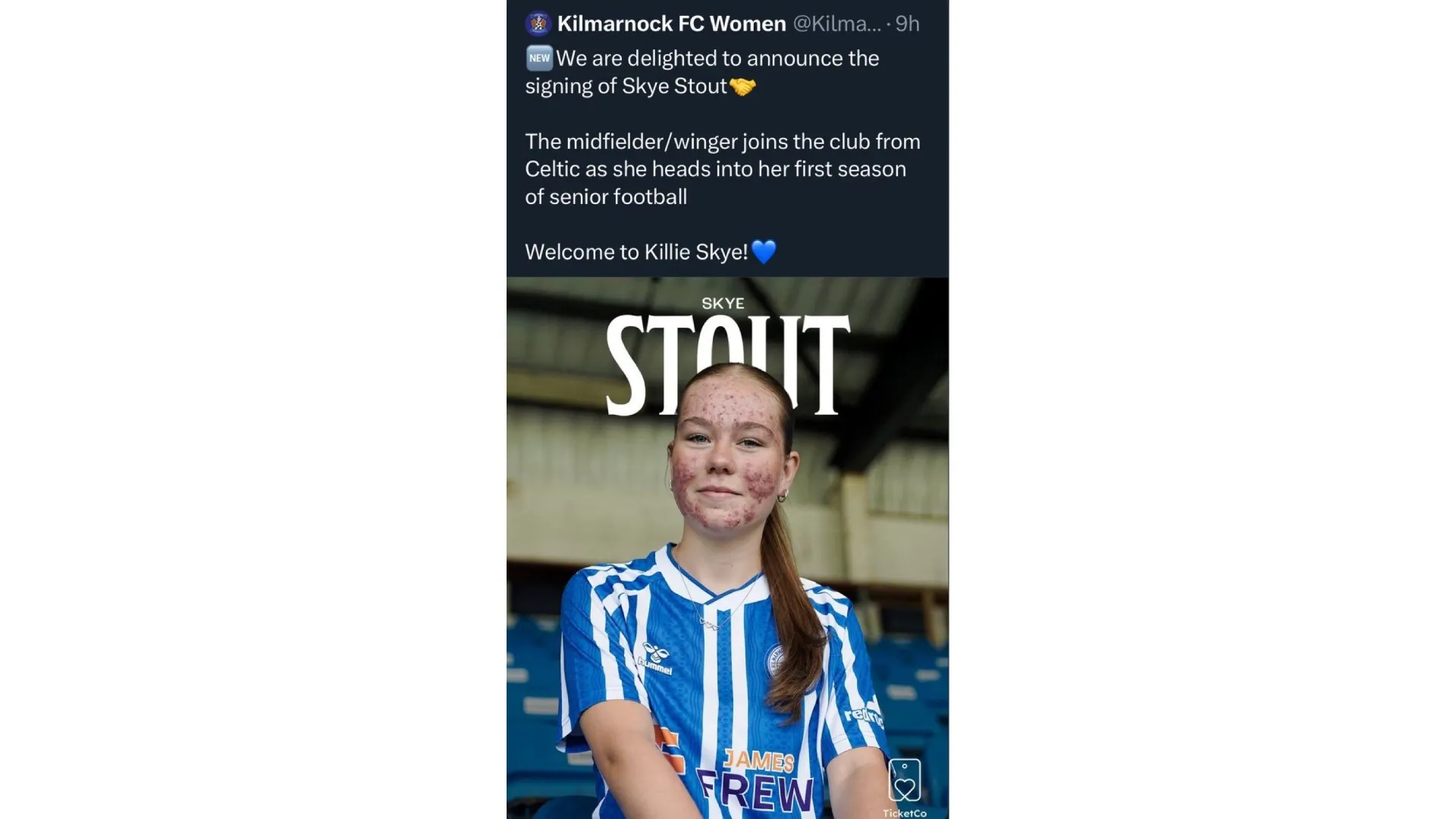 Il post poi rimosso dal Kilmarnock