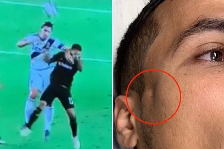 /images/i/b/r/ibrahimovic-rompe-la-faccia.jpg