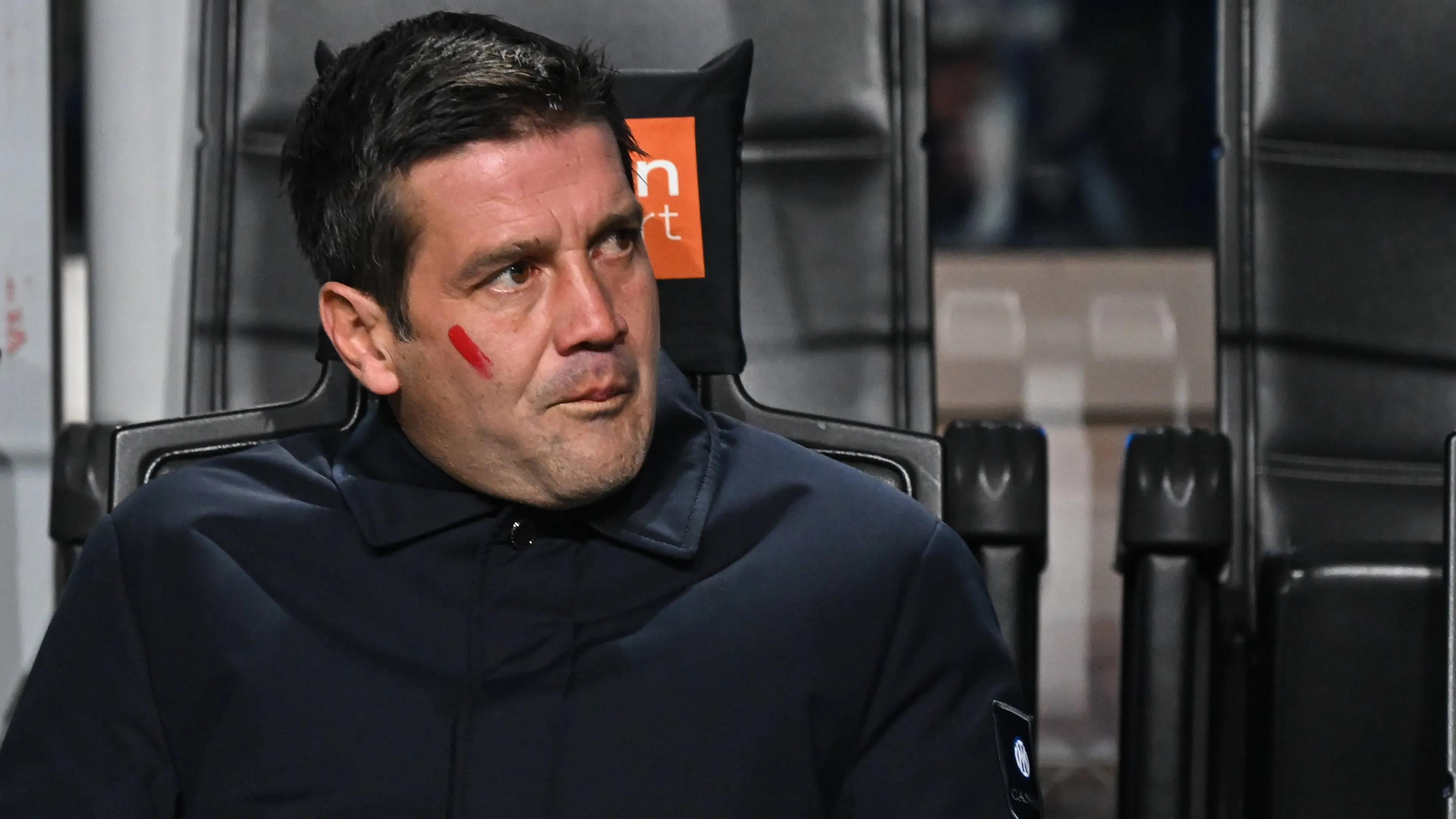 Inter, la fascia destra è un problema: chi gioca al posto di Dumfries?