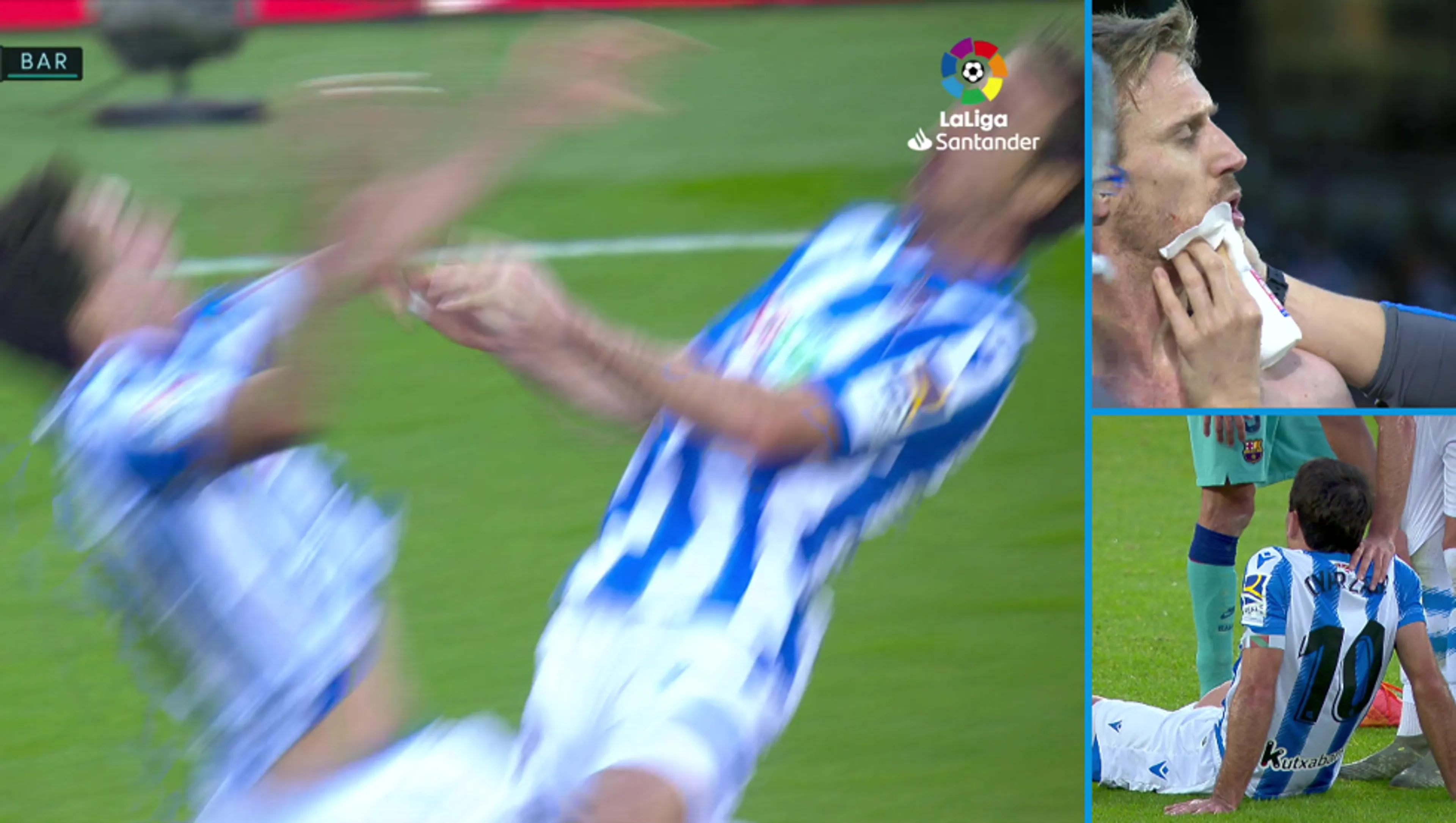 Copertina di Real Sociedad, esultanza assurda: punti di sutura e contusione (VIDEO)
