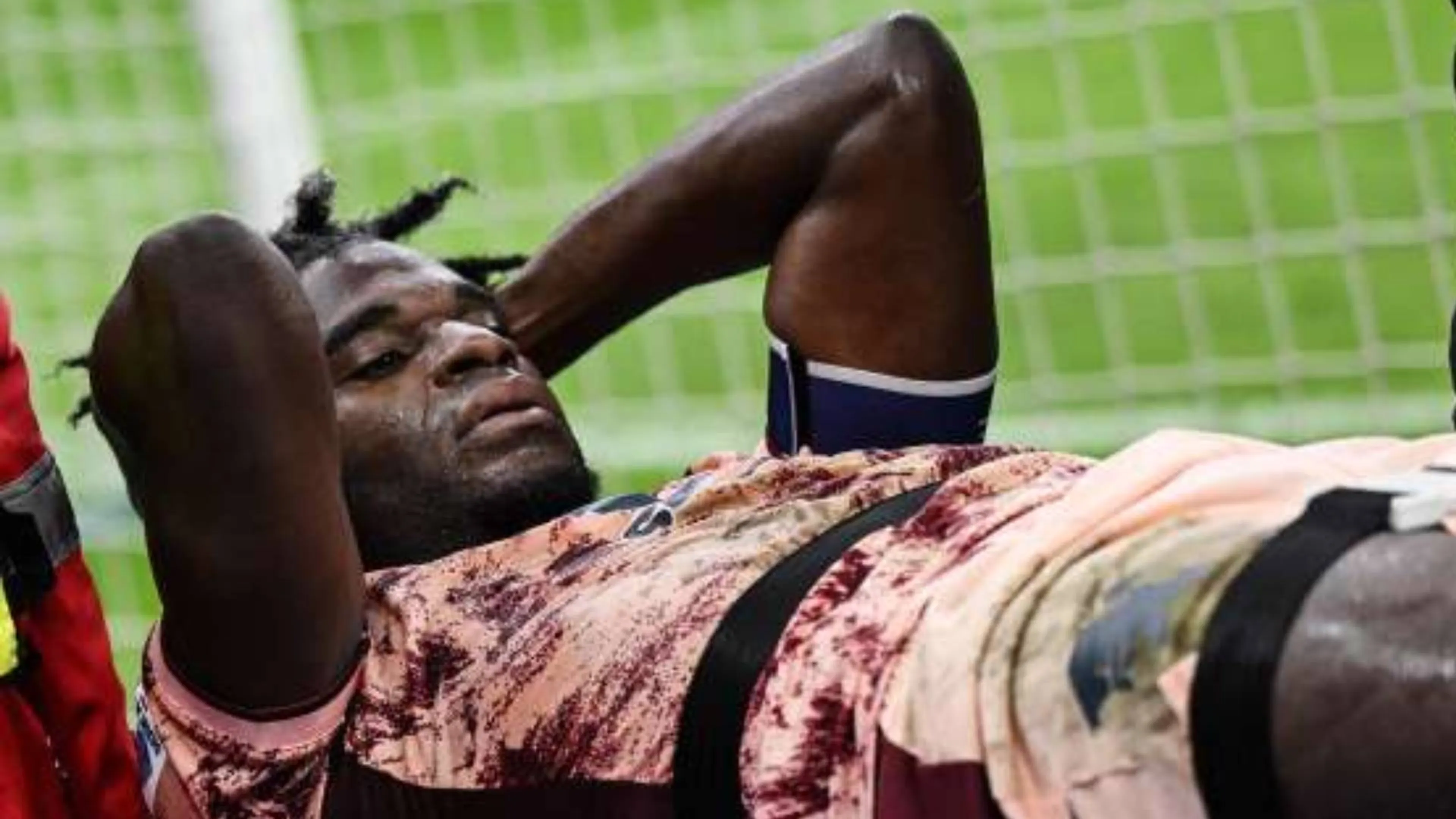 Copertina di Anche Zapata fa crack, le condizioni anche in ottica... Fantacalcio