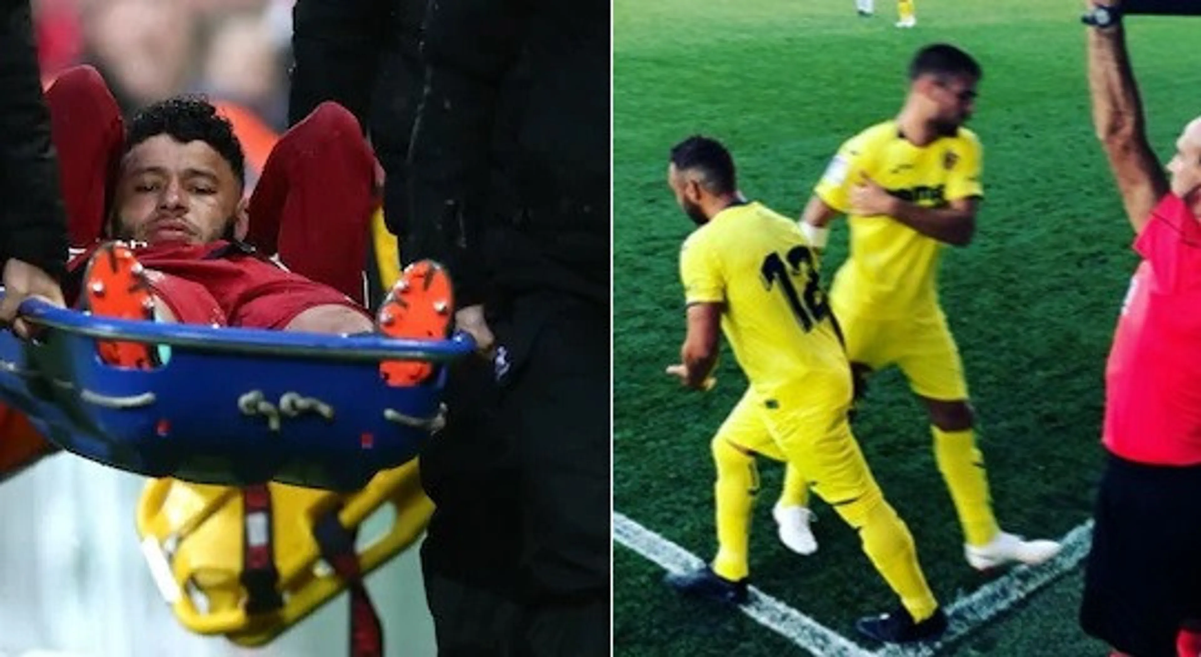 Copertina di Buio e luce. Per Oxlade-Chamberlain una notizia “shock”, mentre Santi…