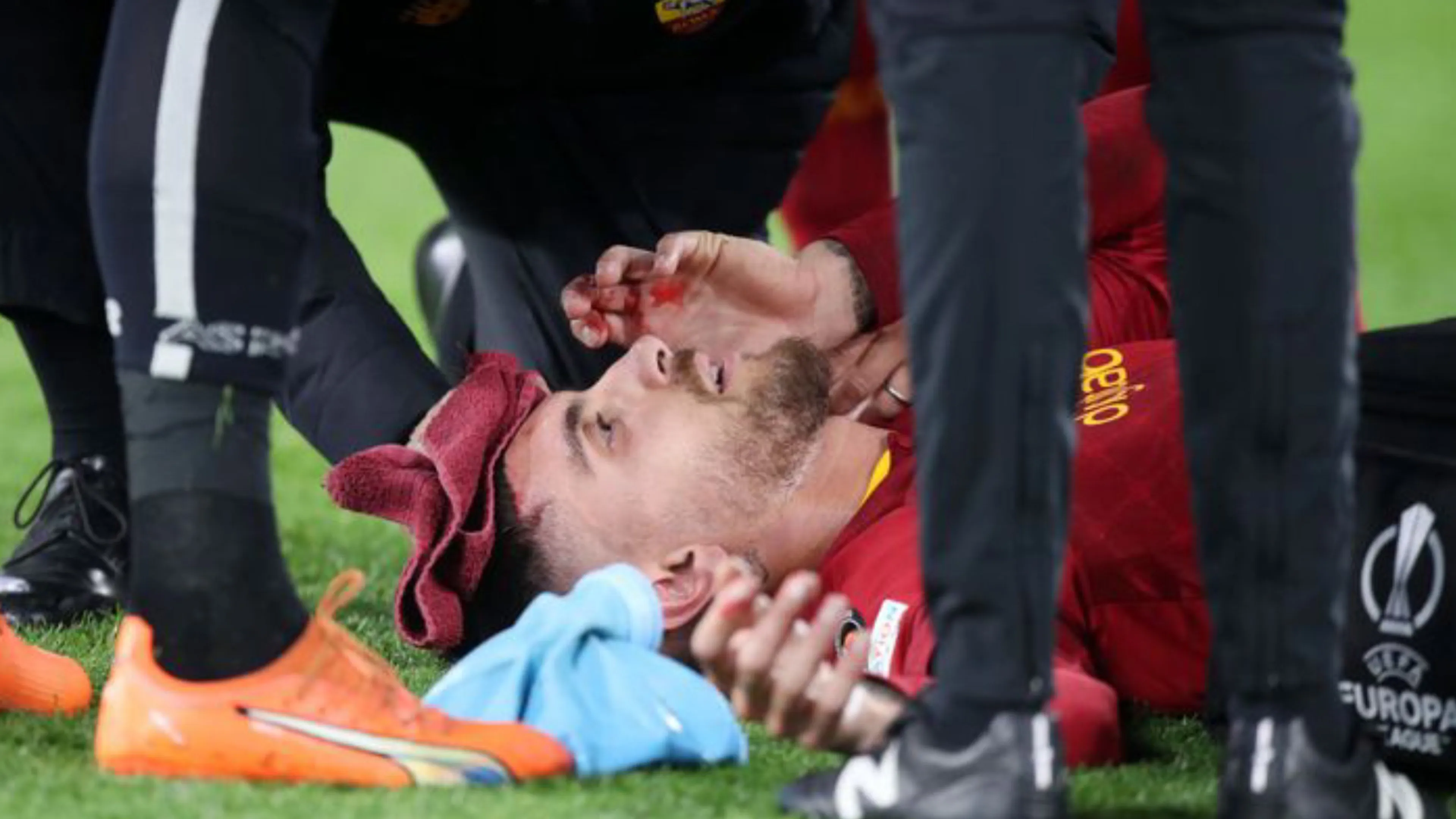 Copertina di Roma-Real Sociedad: ferite e sangue sul volto, attimi di paura per Pellegrini