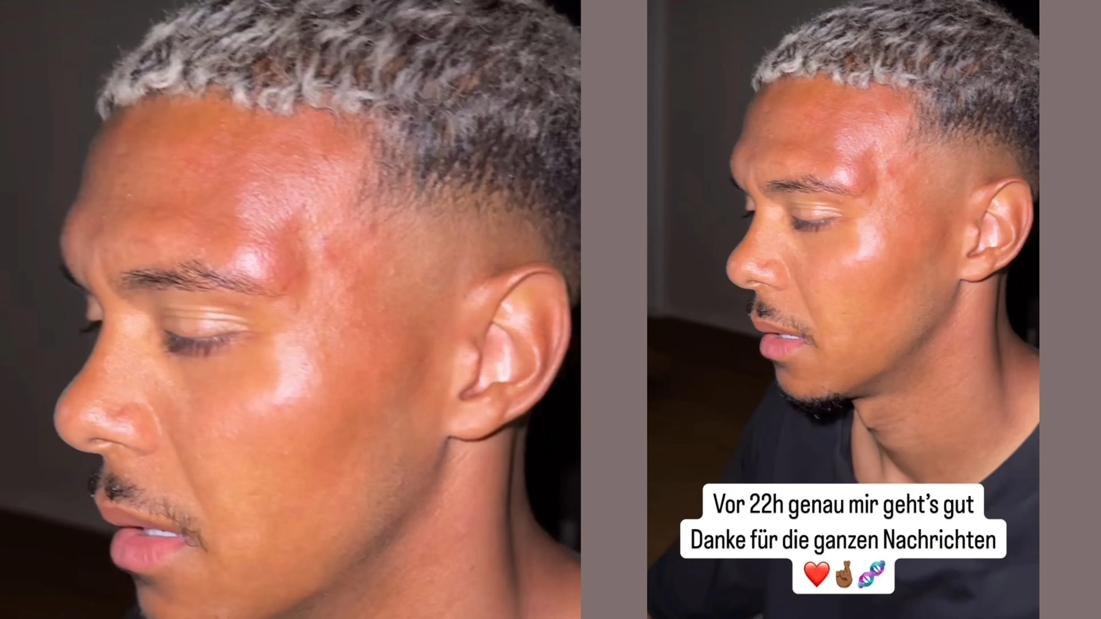 Copertina di Sommer del Norimberga aggredito dai suoi tifosi dopo un post sui social
